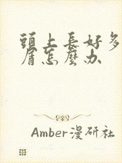 头上长好多头皮屑怎么办