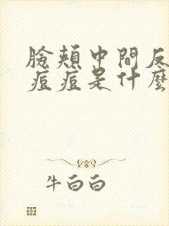 脸颊中间反复长痘痘是什么原因引起的