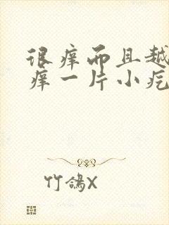 很痒而且越挠越痒一片小疙瘩