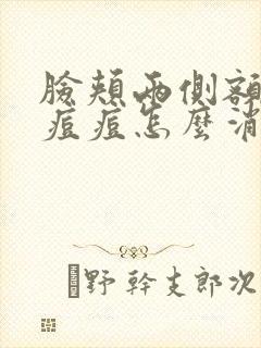 脸颊两侧额头长痘痘怎么消除