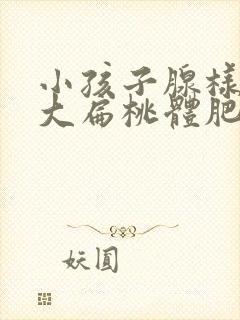 小孩子腺样体肥大扁桃体肥大一定要做手术吗