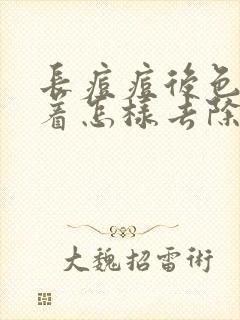 长痘痘后色素沉着怎样去除