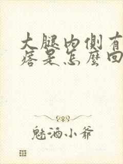 大腿内侧有软疙瘩是怎么回事