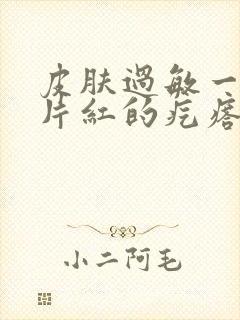 皮肤过敏一抓一片红的疙瘩怎么办