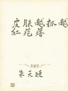 皮肤越抓越痒起红疙瘩