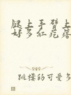 腿上手臂上起了好多红疙瘩而且很痒怎么办?