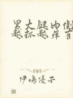 男大腿内侧痒痒越抓越痒有小红疙瘩