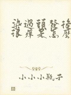 染过头发后头皮很痒是怎么回事封面