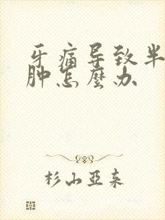 牙痛导致半边脸肿怎么办封面