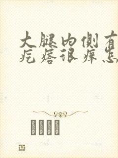 大腿内侧有小红疙瘩很痒怎么回事