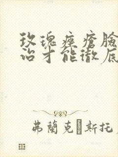 玫瑰痤疮脸怎么治才能彻底根除