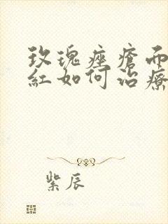 玫瑰痤疮面部潮红如何治疗好