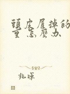 头皮屑掉的太严重 怎么办