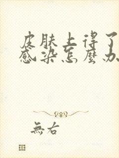 皮肤上得了真菌感染怎么办