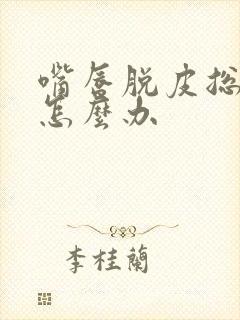 嘴唇脱皮总不好怎么办