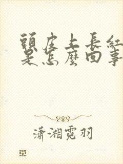 头皮上长红疹子是怎么回事