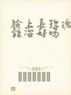 脸上长玫瑰痤疮能冶好吗