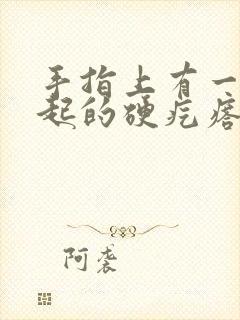 手指上有一个凸起的硬疙瘩挂什么科