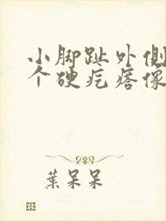 小脚趾外侧长了个硬疙瘩像茧走路疼