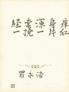 经常浑身痒痒,一挠一片红还起疙瘩