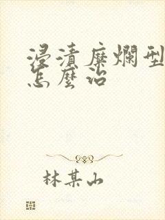 浸渍糜烂型脚气怎么治