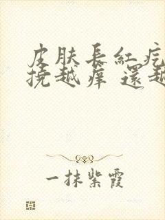 皮肤长红疙瘩越挠越痒 还越变越多