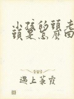 小孩的头老是摇头是怎么回事