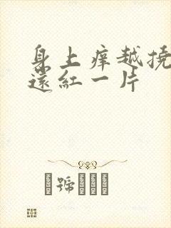 身上痒越挠越痒还红一片