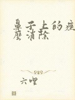 鼻子上的痤疮怎么消除