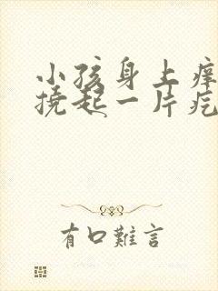 小孩身上痒痒一挠起一片疙瘩怎么回事