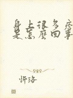 身上很多疹子痒是怎么回事