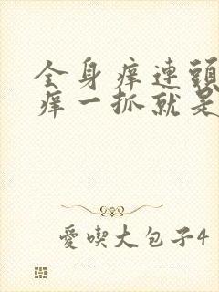 全身痒连头皮都痒一抓就是疙瘩封面