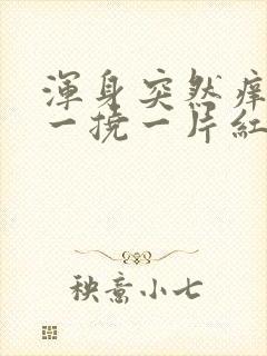 浑身突然痒痒,一挠一片红还起疙瘩