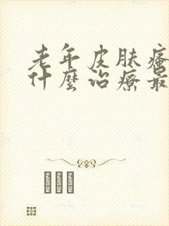 老年皮肤瘙痒用什么治疗最好