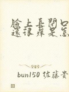 脸上长闭口粉刺还很痒是怎么回事