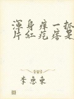 浑身痒一抓就一片红疙瘩是怎么回事