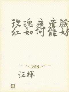 玫瑰痤疮脸颊发红如何能好