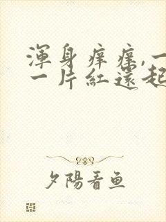 浑身痒痒,一挠一片红还起疙瘩