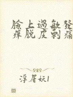 脸上过敏发红发痒脱皮刺痛