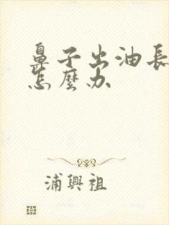 鼻子出油长痤疮怎么办