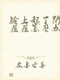 脸上起了闭口的痘痘怎么办