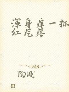 浑身痒一抓就起红疙瘩封面