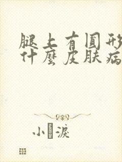 腿上有圆形癣是什么皮肤病