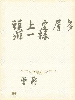 头上皮屑多,像癣一样