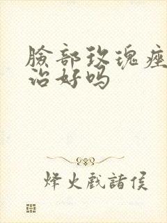 脸部玫瑰痤疮能治好吗