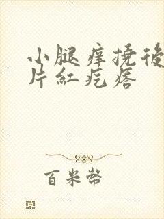 小腿痒挠后起一片红疙瘩封面