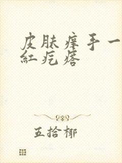 皮肤痒手一抓起红疙瘩