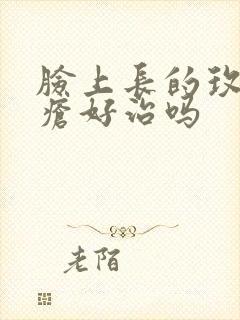 脸上长的玫瑰痤疮好治吗