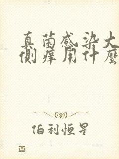 真菌感染大腿内侧痒用什么药