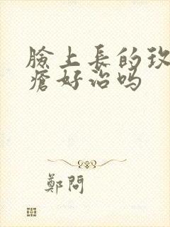 脸上长的玫瑰痤疮好治吗